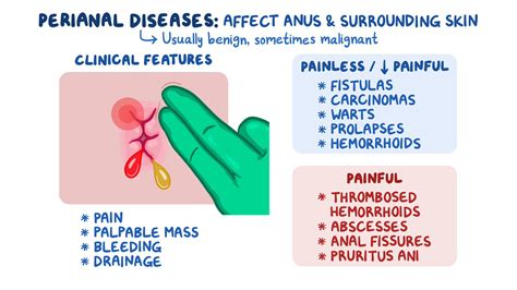 Approach to perianal problems: Clinical sciences - Osmosis Video Library
