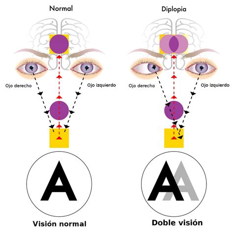 Image result for Binocular Vision Test