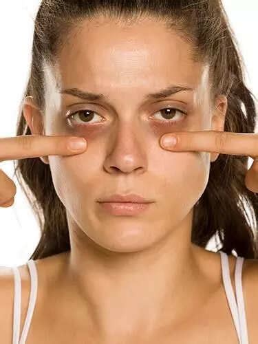 5 Habits That Are Worsening Your Dark Circles | Skincare & Makeup News ...