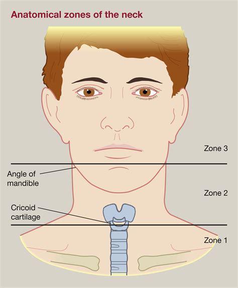 Neck trauma management - Surgery - Oxford International Edition