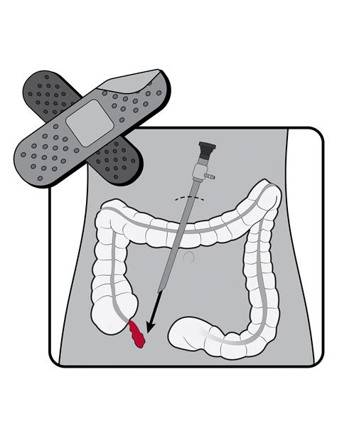 Surgery 的图像结果