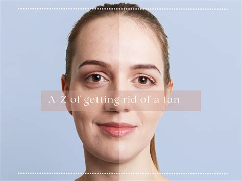 A-Z of getting rid of a tan | Tan Removal Treatments - FAITH & PATIENCE ...