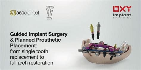 Guided Implant Surgery & Planned Prosthetic Placement, Sheraton ...