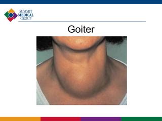 Image result for Thyroid Function Algorithm