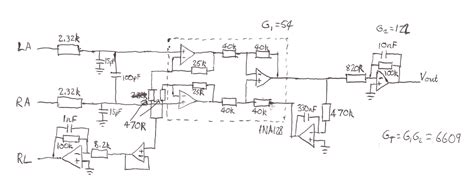 Image result for Microprocessor-Based ECG