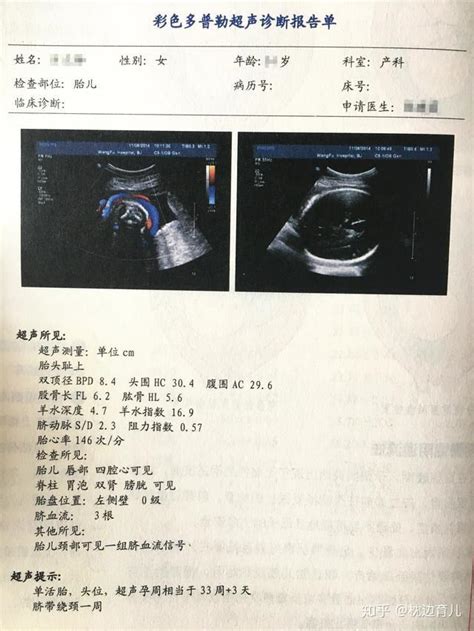 孕3月男女胎儿个性藏得深，摸清B超这几个数据，胎儿就没啥秘密了 - 百度宝宝知道
