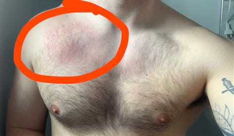 Woman's Chest Pulled Muscle In Chest at Kathryn Staley blog