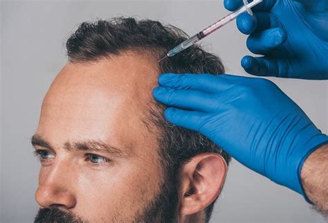 PRP Therapy, Dermatologist in JP Nagar, Skin Specialist in Jaya Nagar