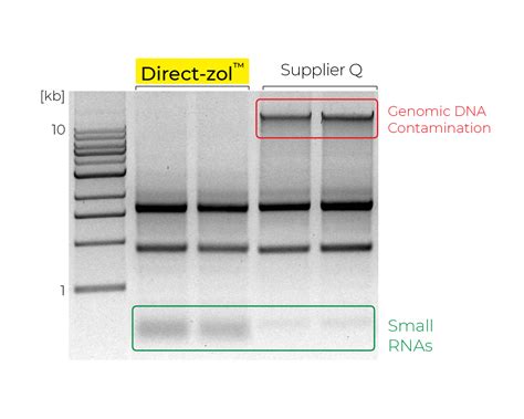 Isolation of RNA From Bacteria 的图像结果