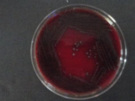 Image result for Enterococcus Chlorination