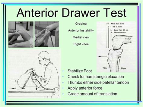 Anterior Drawer Sign Ankle - Drawing Improvement Challenges