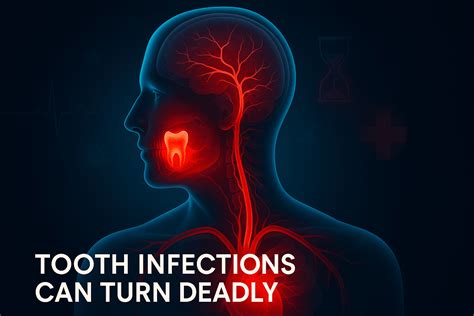 How Long Until a Tooth Infection Kills You? 48 Hours Warning