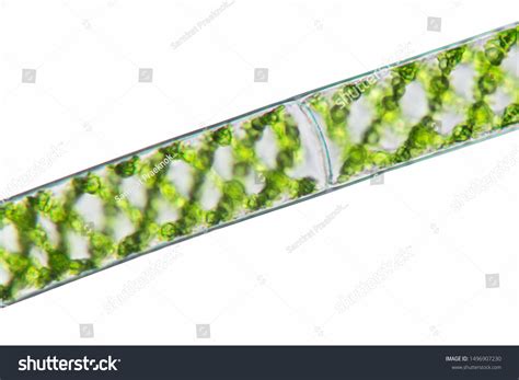 Spirogyra Under Microscope Labeled
