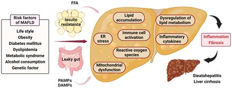 New Insights into the Pathogenesis of Metabolic-Associated Fatty Liver Disease (MAFLD): Gut ...