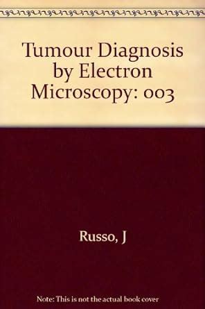 Buy Tumor Diagnosis by Electron Microscopy V 3: 003 Book Online at Low ...