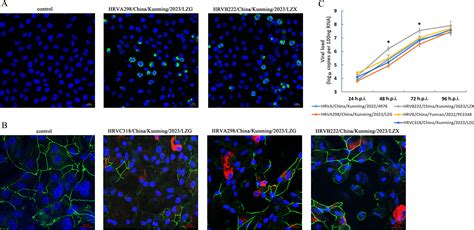 Characteristics of upper respiratory tract rhinovirus in children with ...