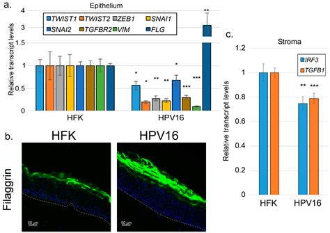 Stromal Interferon Regulatory Factor 3 Can Antagonize Human ...