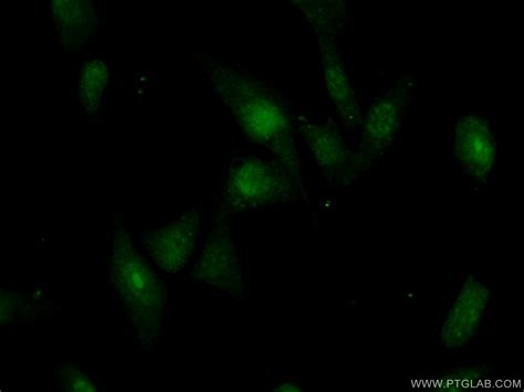 RBM28 antibody (16484-1-AP) | Proteintech
