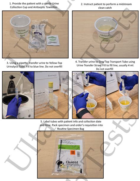 Urinalysis Complete with Reflex to Culture | Ulta Lab Tests