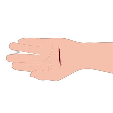 Prothrombin Time INR Test (PT INR Test) at ₹349 – healthcare nt sickcare