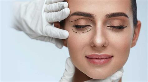 Göz Kapağı Ameliyatı