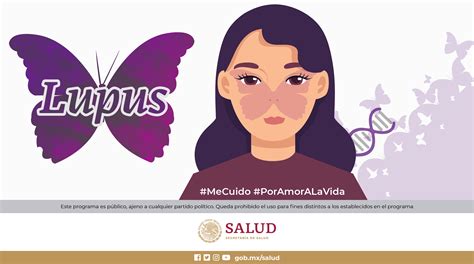 De cada 10 personas con lupus, entre siete y nueve son mujeres ...
