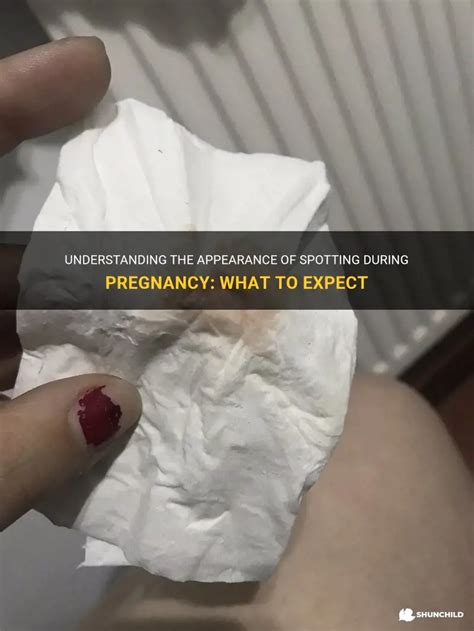 Understanding The Appearance Of Spotting During Pregnancy: What To ...