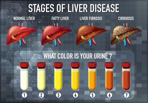 Total Bilirubin Levels: What’s Normal, What’s Not & What It Means ...