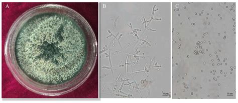 Biocontrol Potential of Trichoderma asperellum CMT10 against Strawberry ...