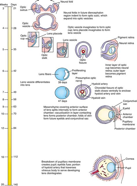 Development of the Eyes - Clinical Tree