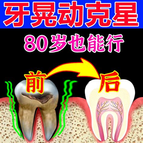 【牙齿松动100%牢固】牙齿松动牙龈委缩牙齿晃动出血肿痛固齿牙膏-淘宝网