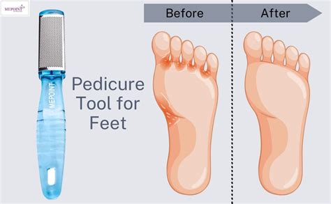 Double Sided Foot Scrubber for Dead Skin,Pedicure Tools for Feet,Foot ...