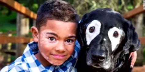 Boy and dog share bond of rare skin condition