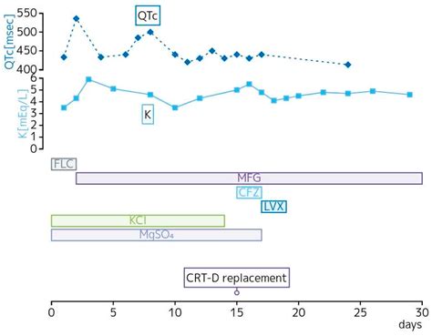 Qtcf Interval QTc Interval Related Toxicity Grading | Download Table
