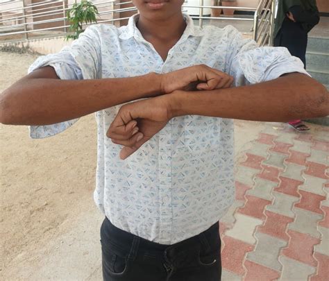 Nearly 200 children of this Karnataka government residential school ...