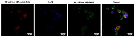Pharmaceutics | Special Issue : Nanocarriers for Drug Delivery Systems