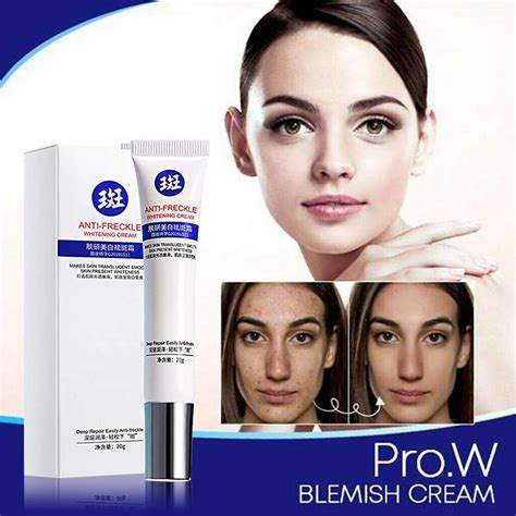 Buy LifeBest Crema de eliminación de manchas anti-imperfecciones Pomada ...