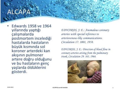 ALCAPA - ARCAPA (Anomalous left or right coronary artery from the ...