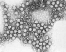 calicivirus 的图像结果