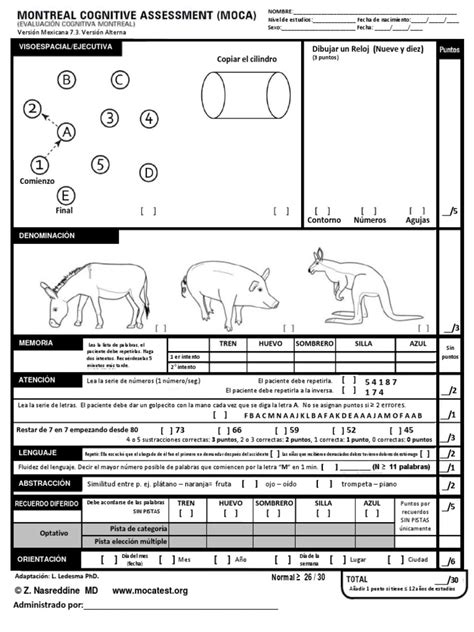 MOCA Test Examples 的图像结果