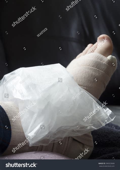 Bag Ice On Broken Fractured Sprained Stock Photo 396923668 - Shutterstock