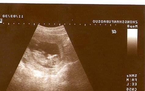 孕34周变化：准妈妈身体浮肿，胎宝宝脂肪变厚 - 柚喜问答