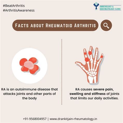 Best Rheumatologist in Meerut | Dr Ankit Jain Meerut