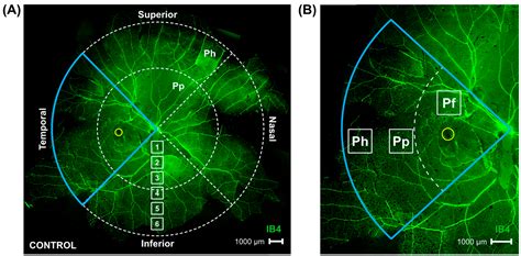 Sustained Experimental Myopia Exacerbates the Effect of Eye Growth on ...