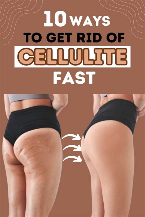Image result for How to Remove Cellulite Fast