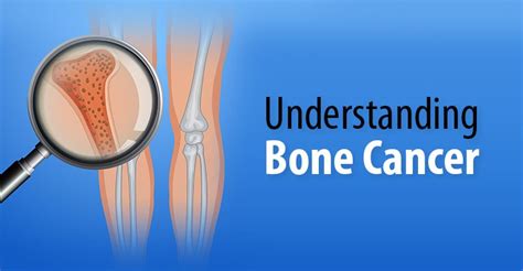 Best Cancer Hospital in Siliguri - Medica Cancer Hospital 2022