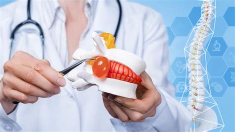 Image result for Disc Surgery