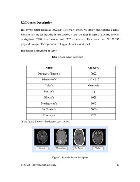 Image result for Brain Tumor Detection Using Machine Learning