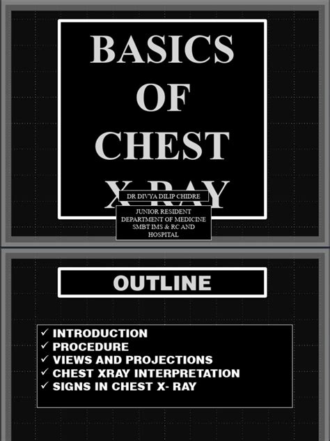 Image result for Chest X-Ray Tutorial