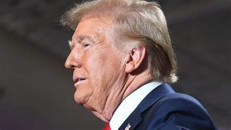 Trump hair photos then and now: Combover, hair part, hiding bald spot